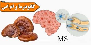 گانودرما | قهوه قهوه گانودرما و ام اس: کمک به کنترل علائم بیماری با نوشیدنی طبیعی