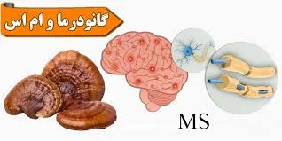 قهوه گانودرما و ام اس: کمک به کنترل علائم بیماری با نوشیدنی طبیعی