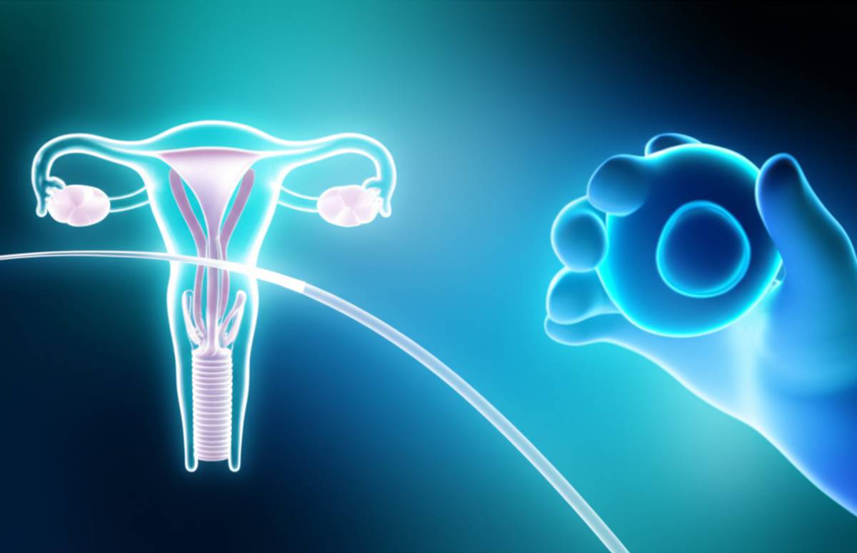 عمل اهدای تخمک: مراحل، شرایط و تمام آنچه باید بدانید