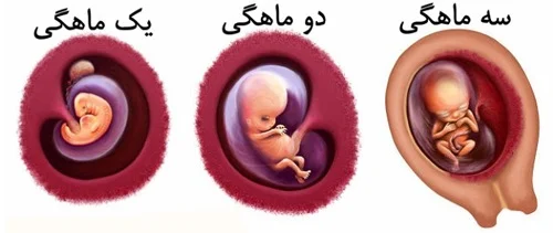 مراقب ‌های سه ماهه اول بارداری