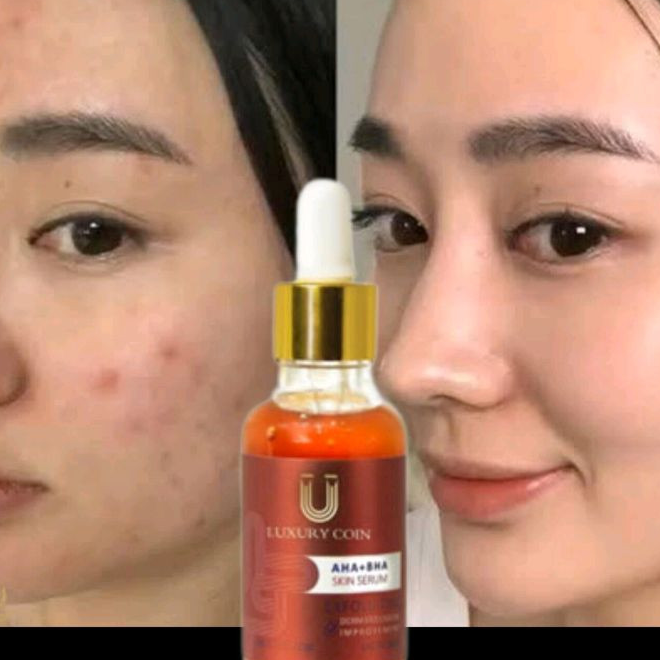 سرم لایه بردار لاکچری کوین