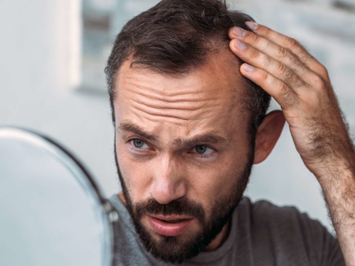 آیا ریزش مو علامت مشکلات تیروئیدی است؟